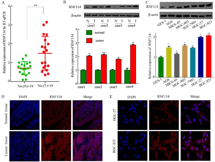 J Cancer Image