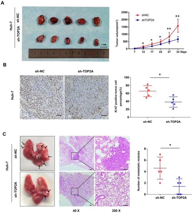 J Cancer Image