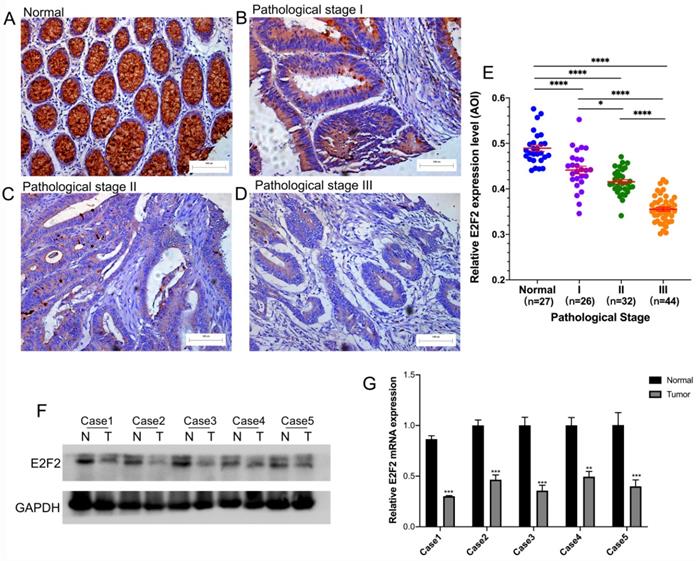 J Cancer Image