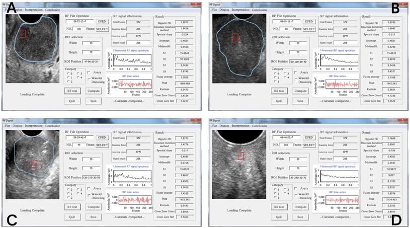 J Cancer Image