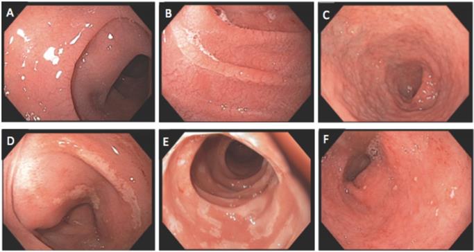 J Cancer Image