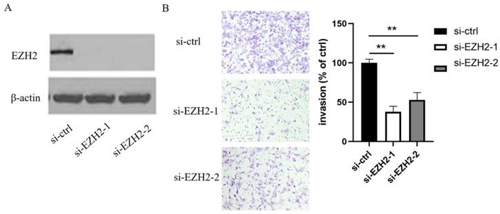 J Cancer Image