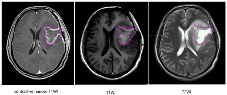 J Cancer Image