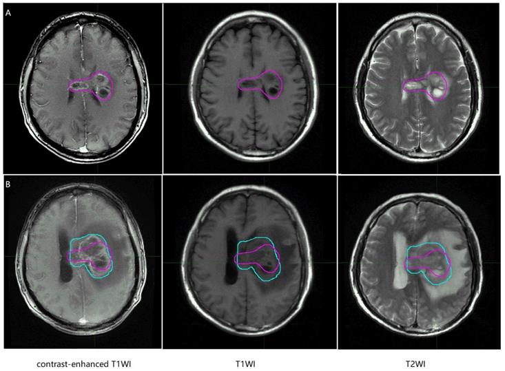 J Cancer Image