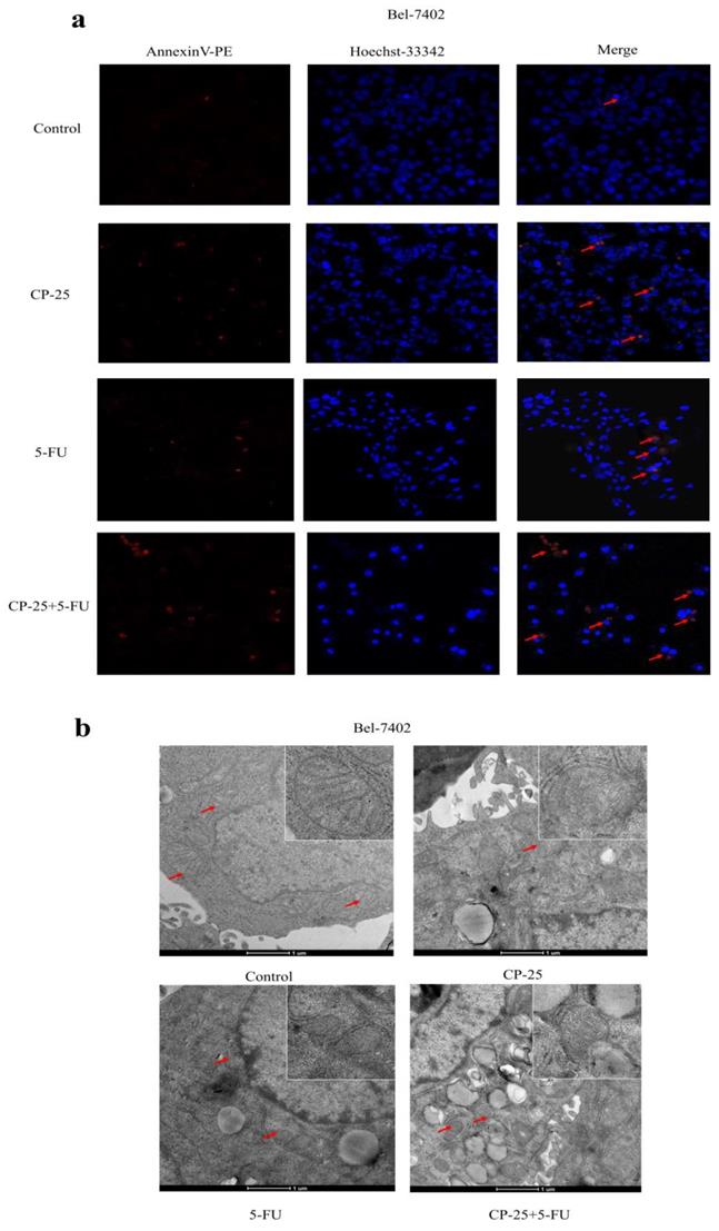 J Cancer Image