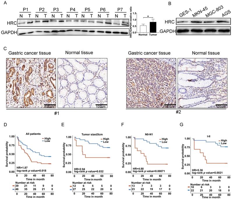 J Cancer Image