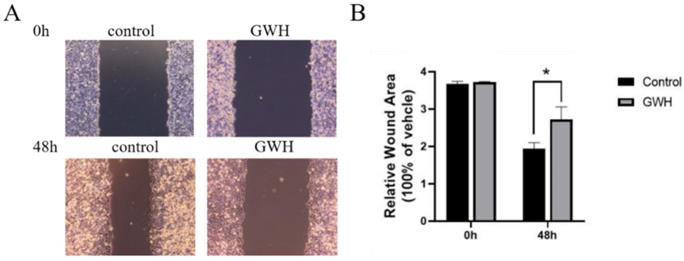 J Cancer Image