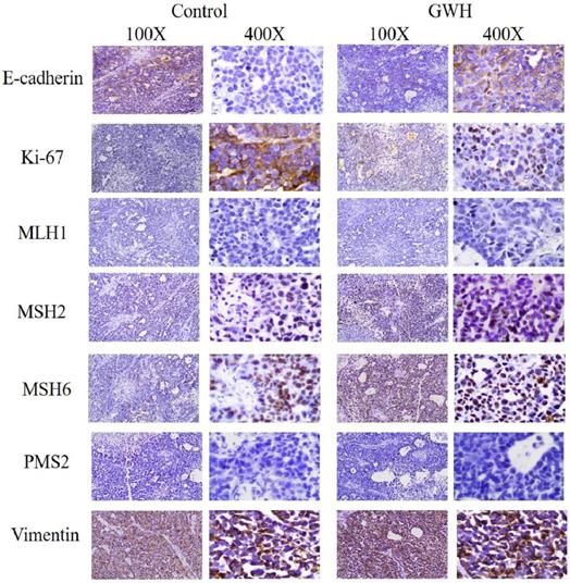 J Cancer Image