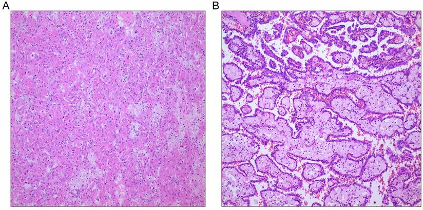 J Cancer Image