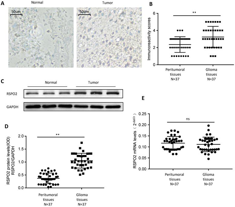 J Cancer Image