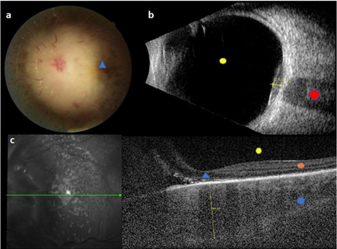 J Cancer Image