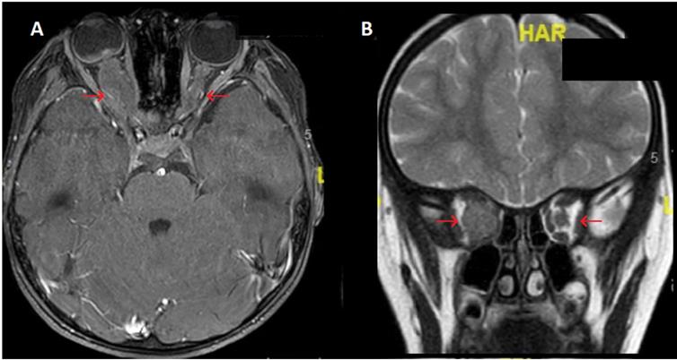 J Cancer Image