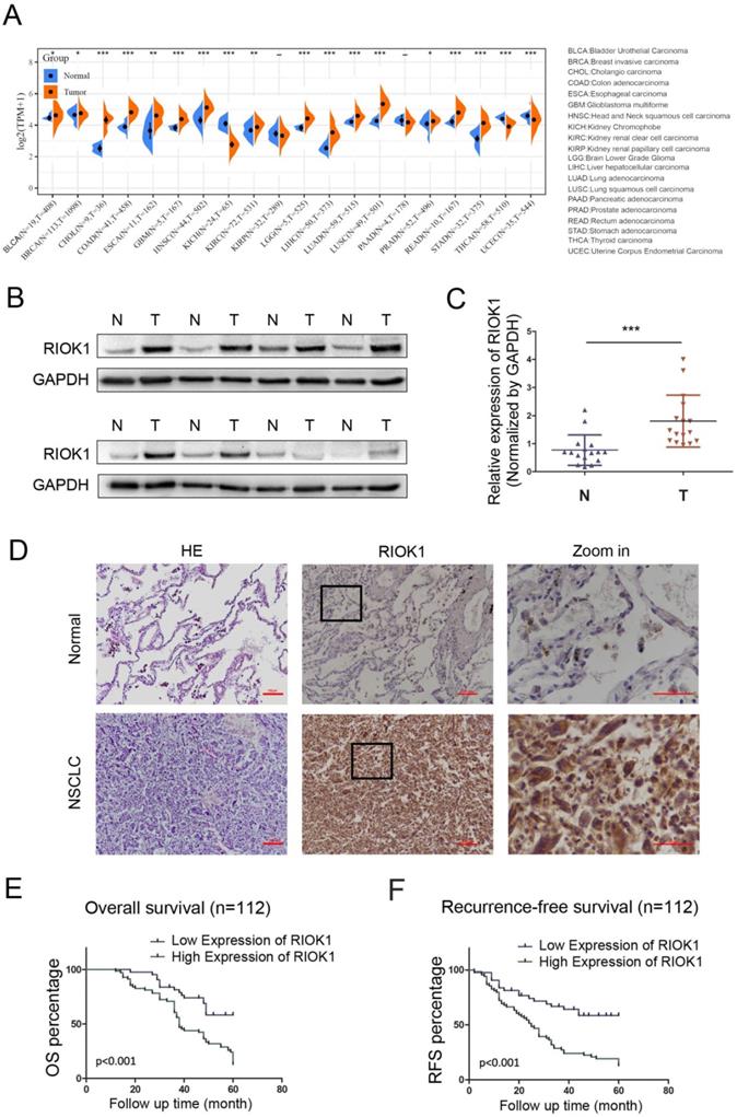 J Cancer Image