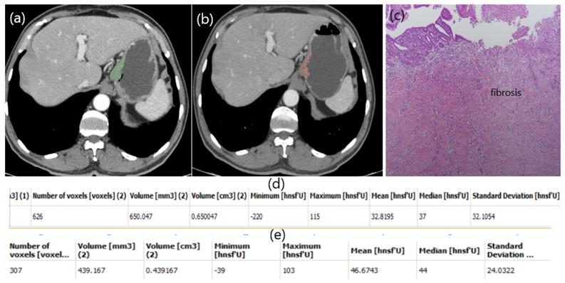 J Cancer Image