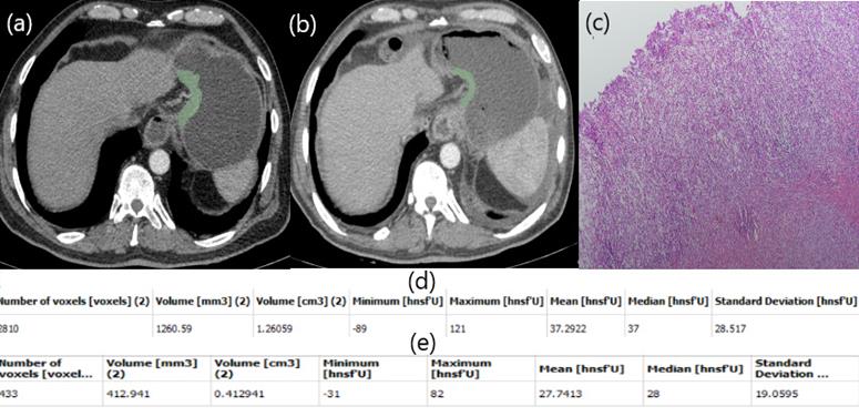 J Cancer Image