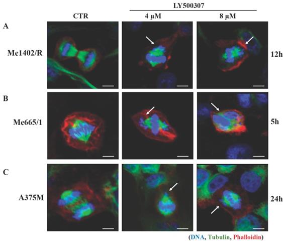 J Cancer Image