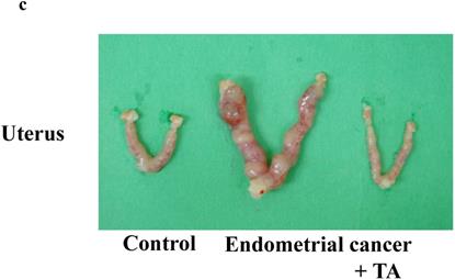 J Cancer Image