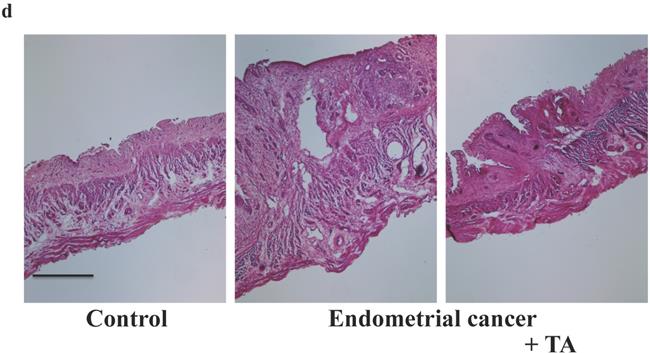 J Cancer Image