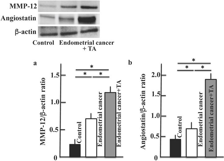 J Cancer Image