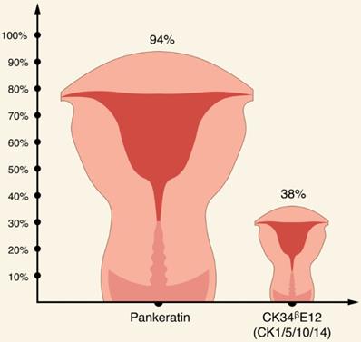 J Cancer Image