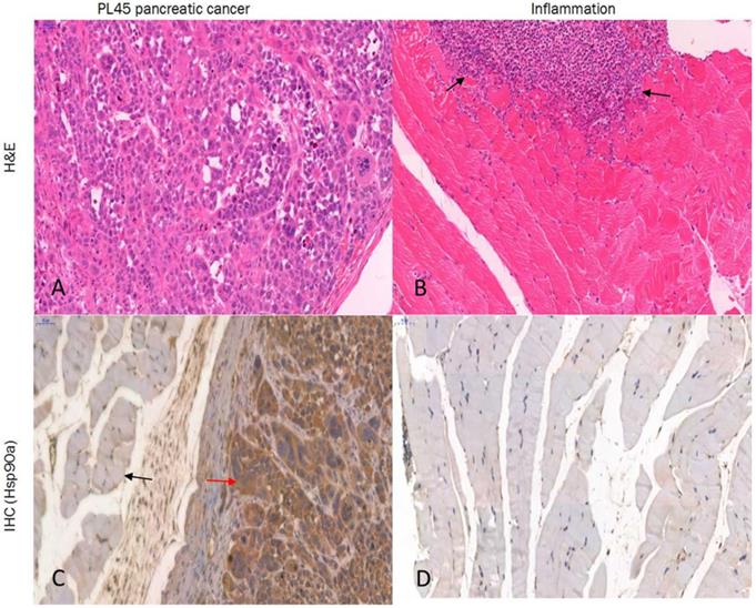 J Cancer Image