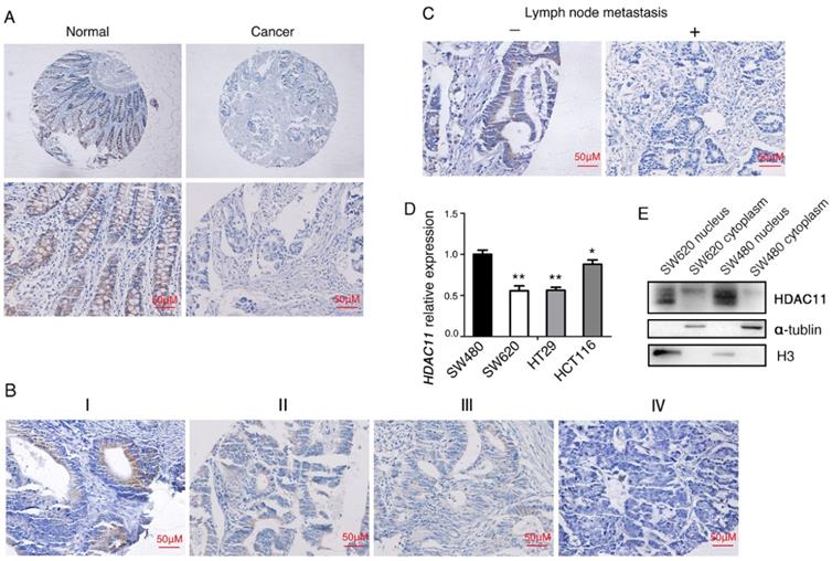 J Cancer Image