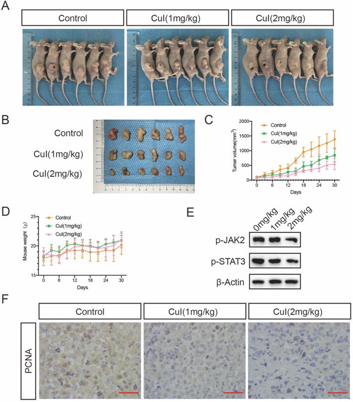 J Cancer Image