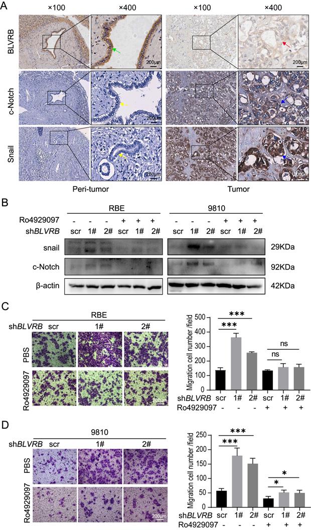 J Cancer Image