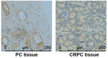 J Cancer Image