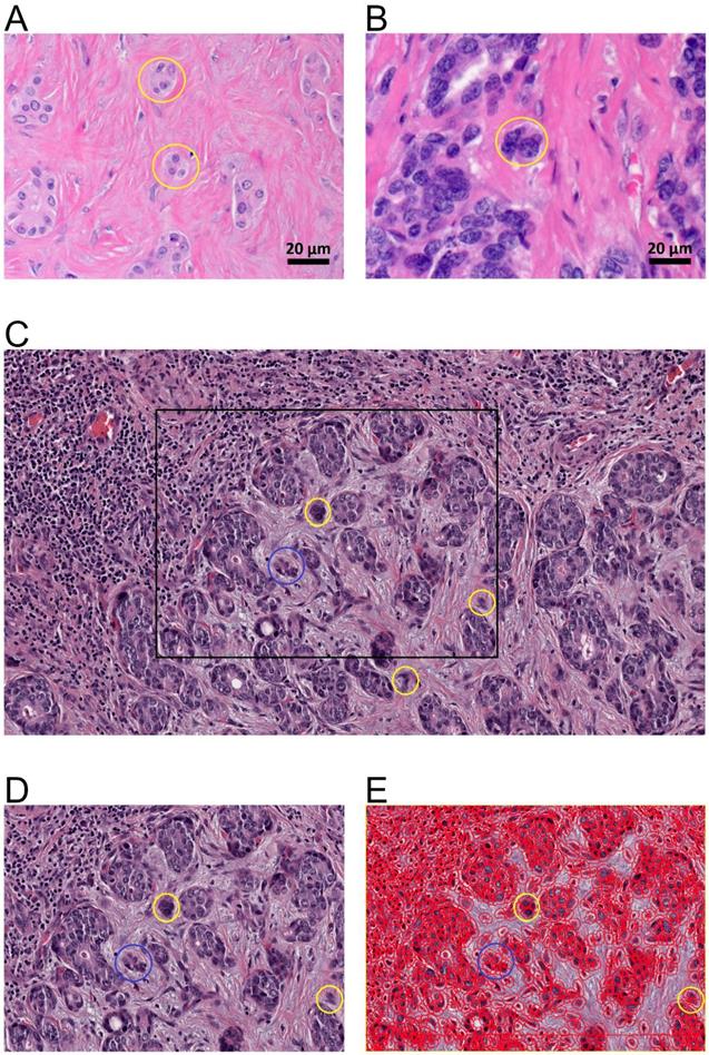 J Cancer Image