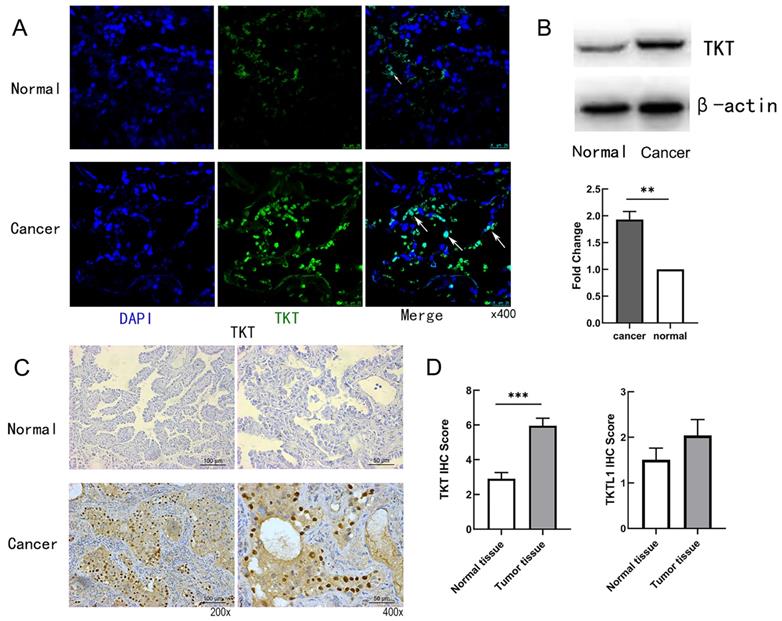 J Cancer Image