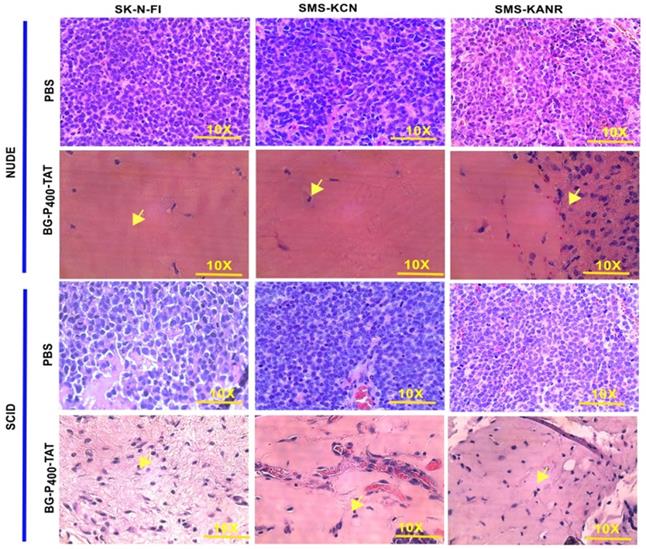 J Cancer Image