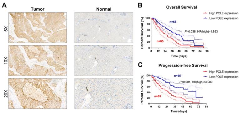 J Cancer Image