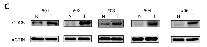 J Cancer Image