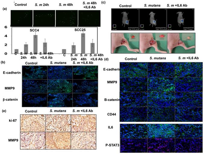 J Cancer Image