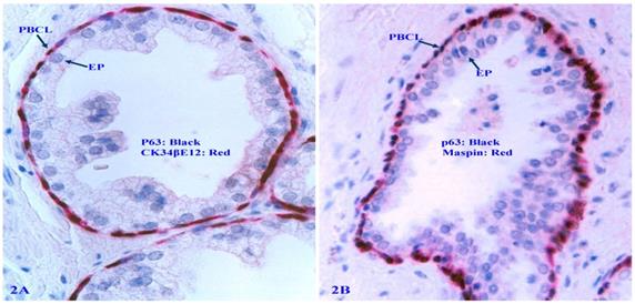 J Cancer Image