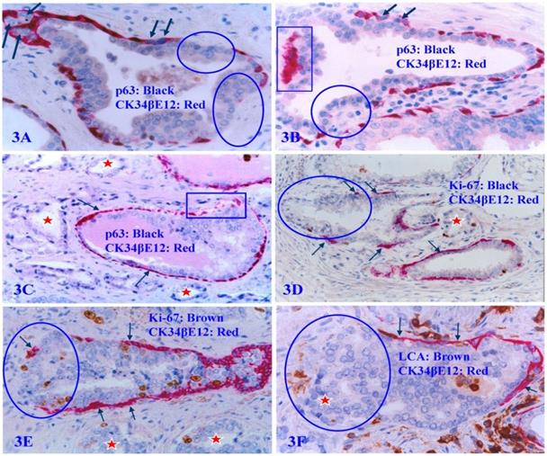 J Cancer Image