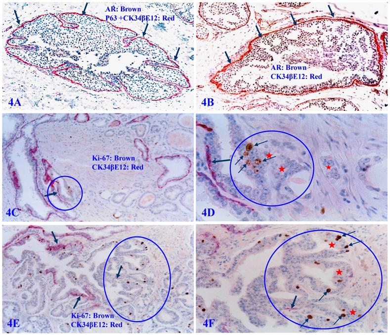 J Cancer Image