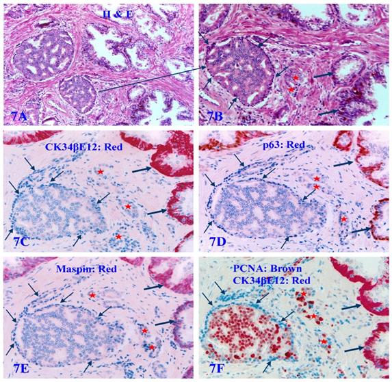 J Cancer Image