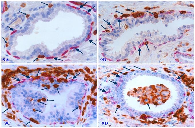 J Cancer Image