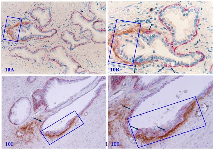 J Cancer Image