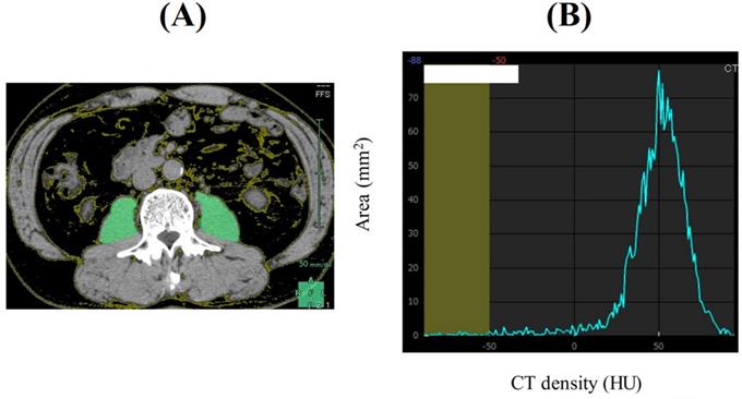 J Cancer Image