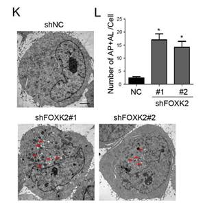 J Cancer Image