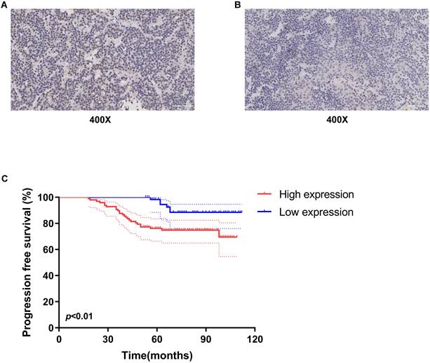 J Cancer Image