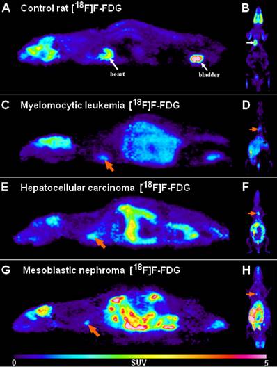 J Cancer Image