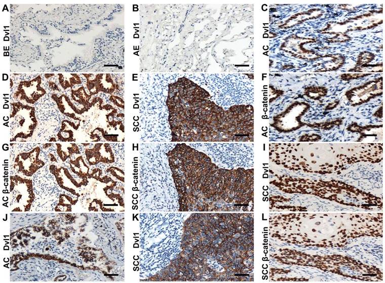 J Cancer Image