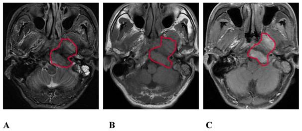 J Cancer Image