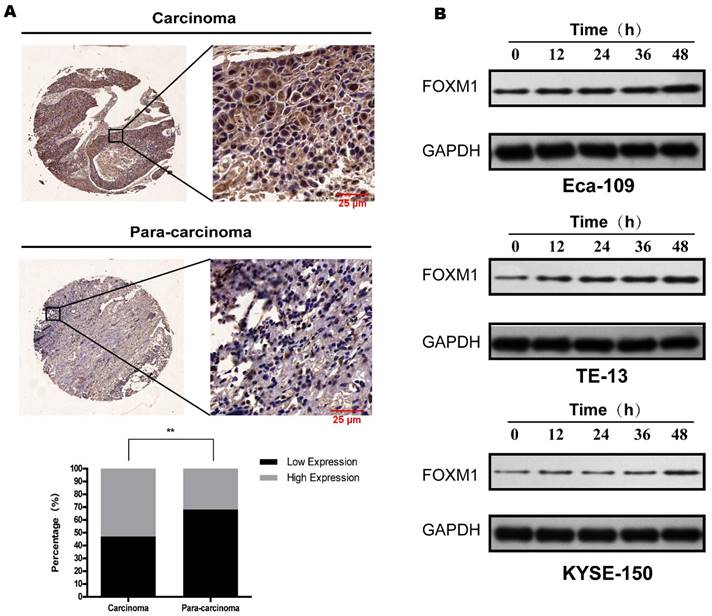 J Cancer Image