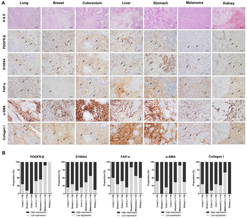 J Cancer Image