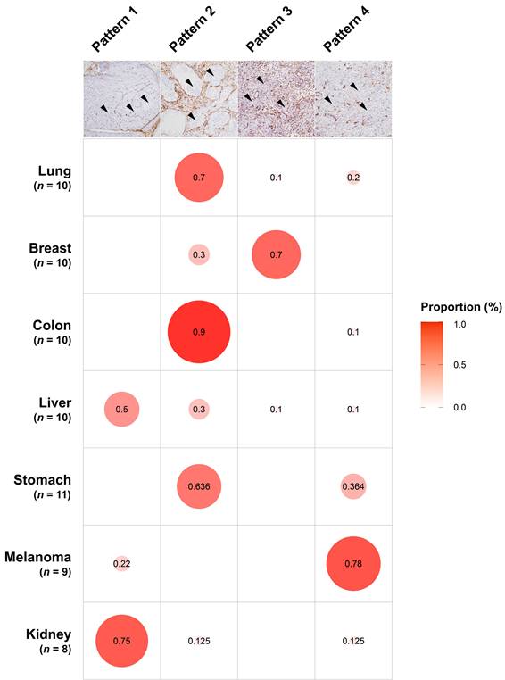 Different Expression and Clinical Implications of CancerAssociated
